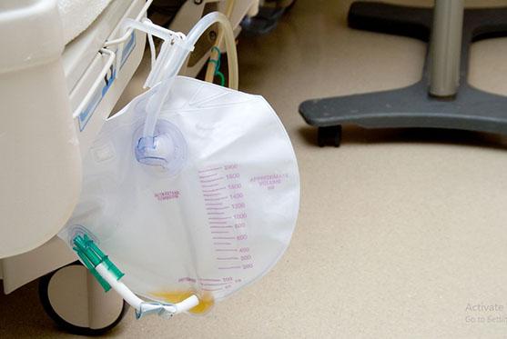 Catheters, Tubes and Drainage Bags